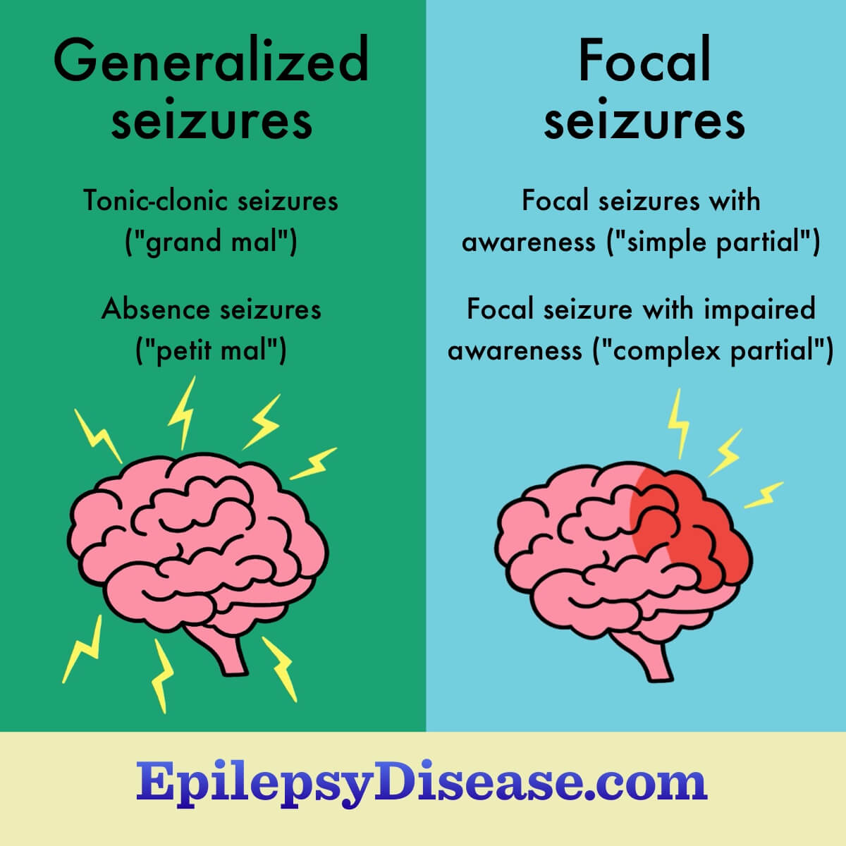 Two brains. One shows electricity all over for generalized seizures. One shows electricity in a small area for focal seizures